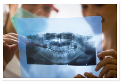 tooth extraction