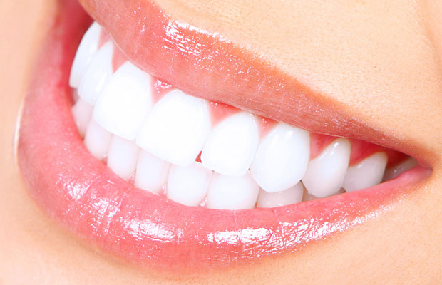 porcelain veneers or composite veneers