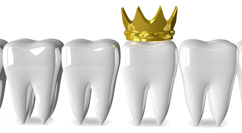 dental crown