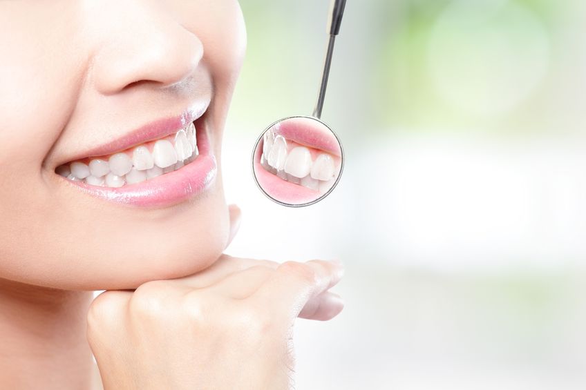 porcelain veneers