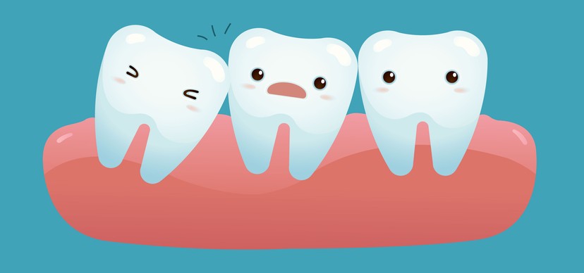 wisdom teeth